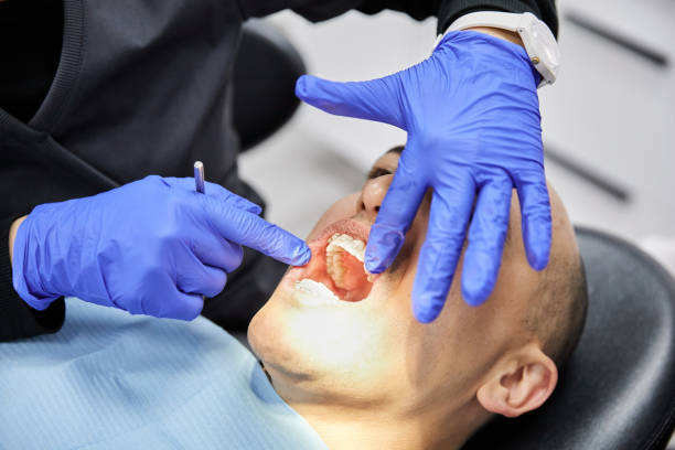 Best Emergency Tooth Extraction in Mathews, LA