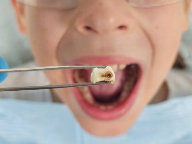 Best Walk-In Emergency Dentist in Mathews, LA