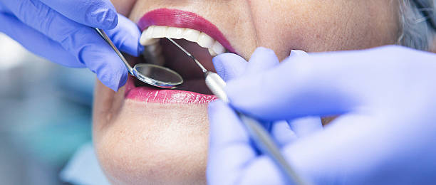 Best Emergency Root Canal Treatment in Mathews, LA